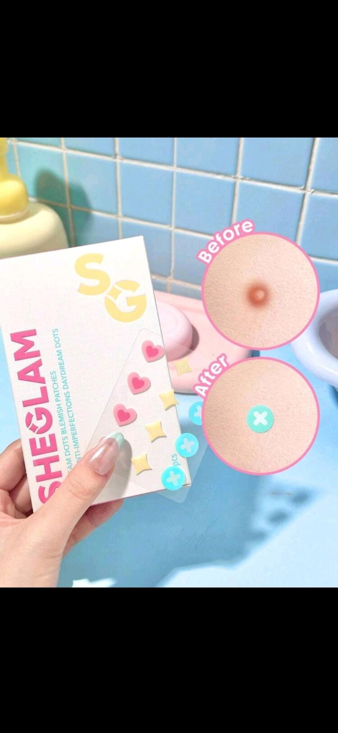 Sheglam Blemishes/Acne Patches